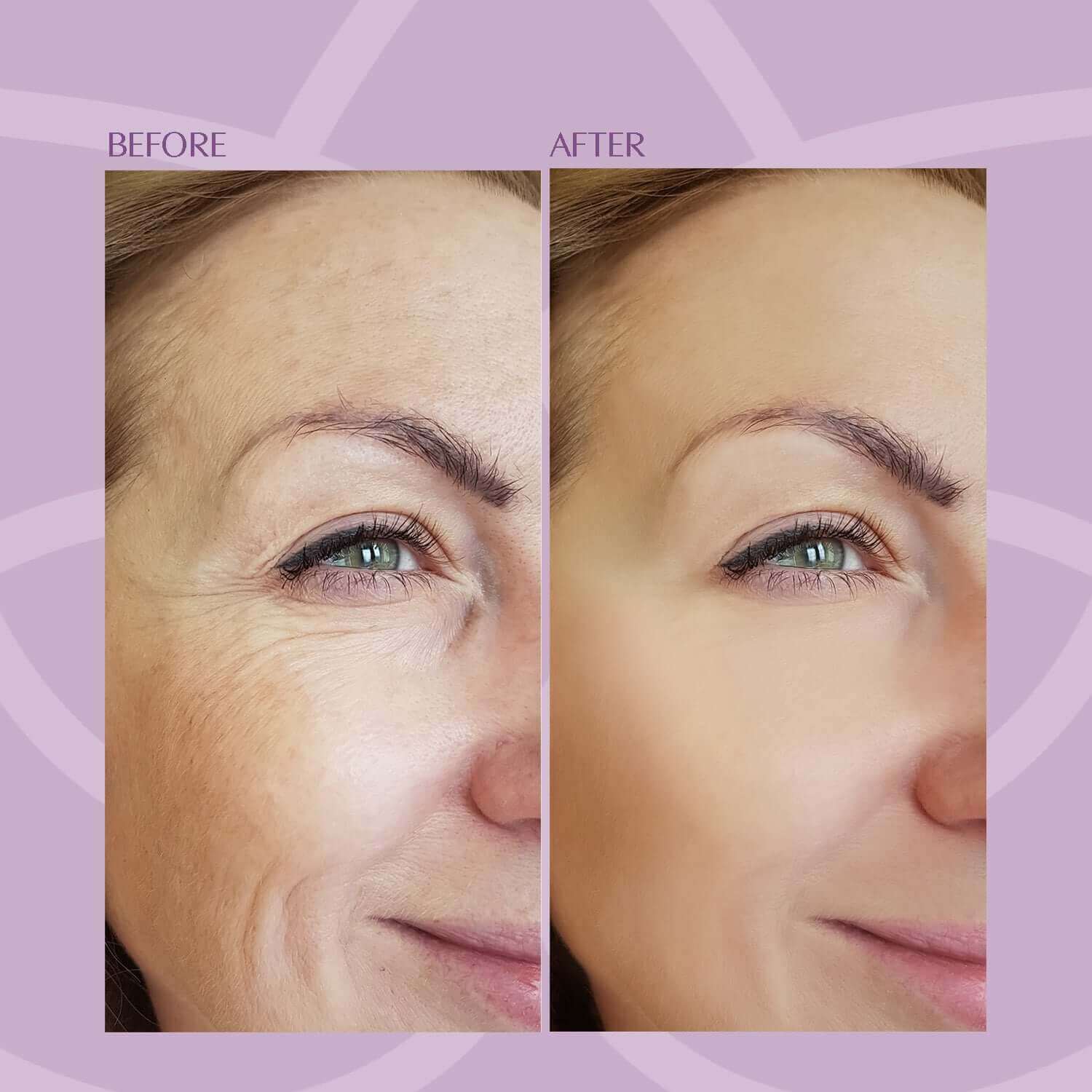 Before and after results with Ultimate Cell Repair Complex
